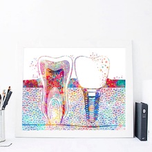 Akvarel plakat tand implantat print tandlæge tandklinik vægindretning hygiejniker kontor kunst medicin lærred maleri