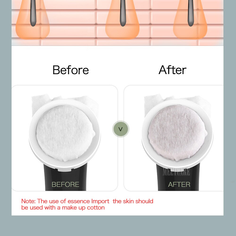 Red Light Therapy LED Photon 4in 1 Face Massage Facial Eye Care Deep Cleaning Face Lifting Skin Rejuvenation Beauty Dervice