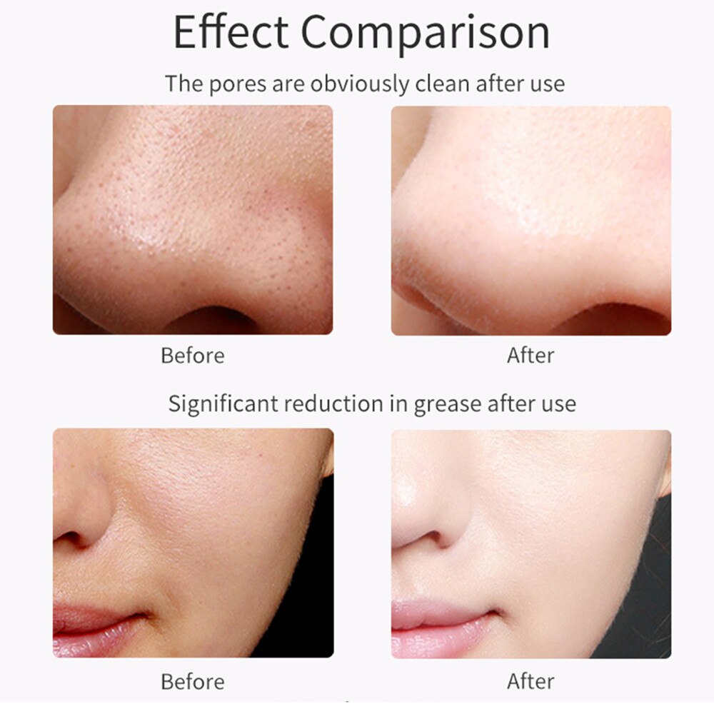 Wibracje ultradźwiękowe skruber skóry twarzy usuwająca zaskórniki szczotka robić twarzy łopata czysty peeling podnoszenie twarzy głębokie czyszczenie twarzy