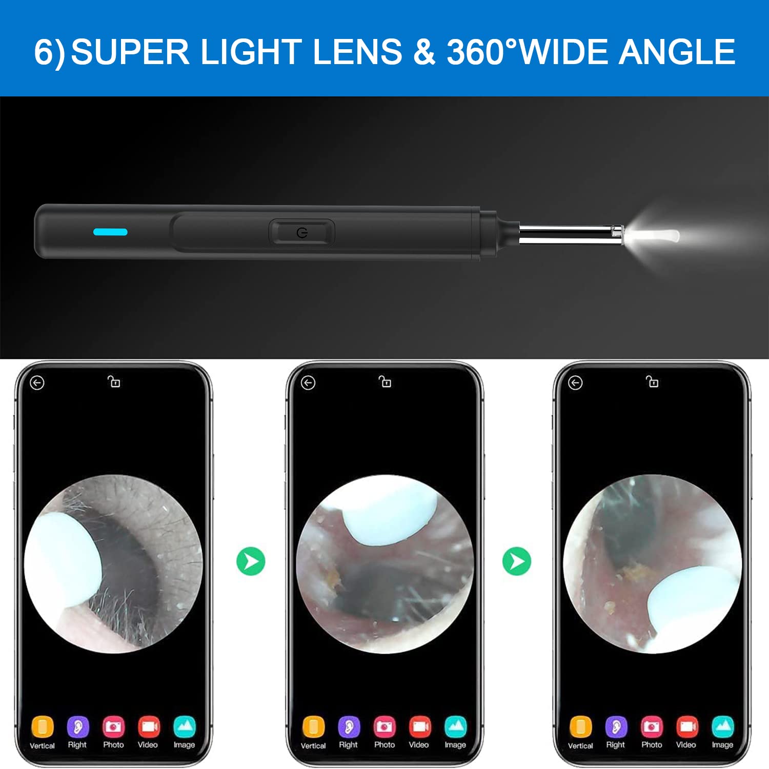 Oor Wax Visuele Oor Plukken Cleaner Met 1080P Hd Camera Oor Camera Otoscoop Met Licht, oor Wax Verwijderen Kit Iphone Ipad Android