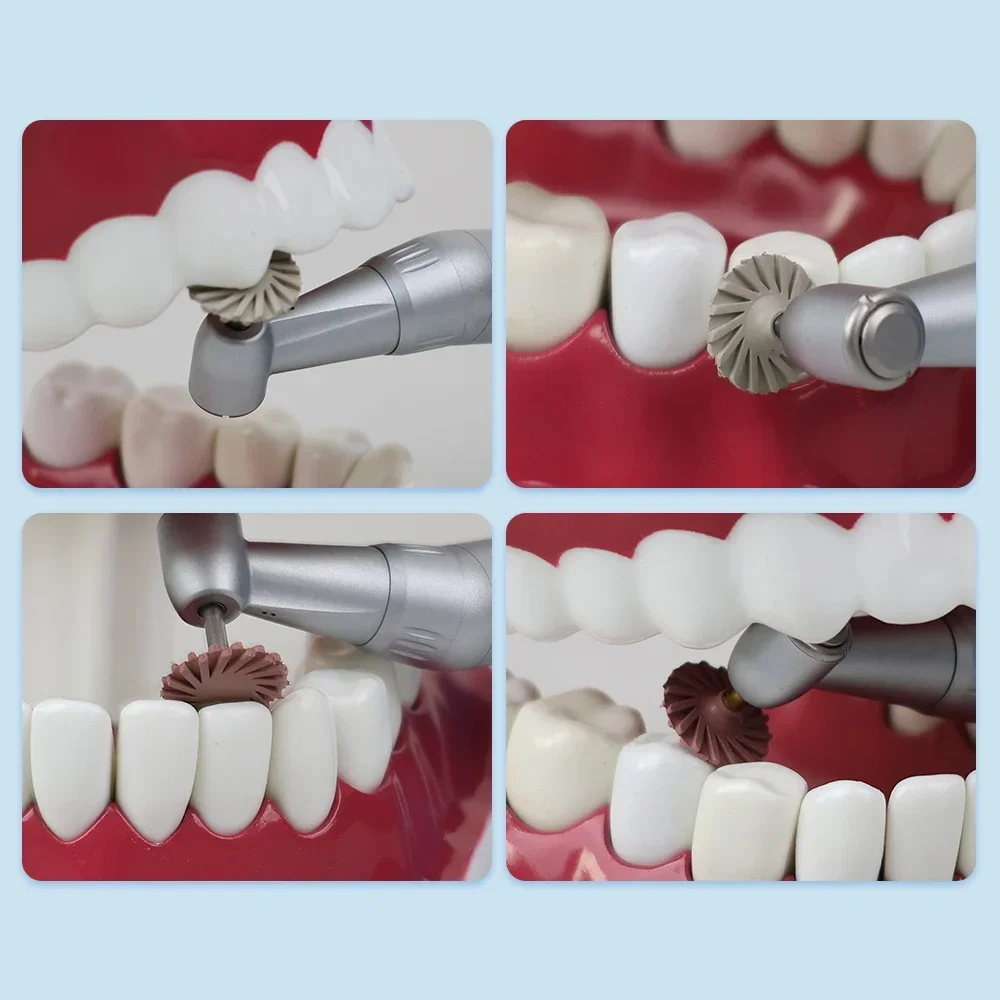 ELIJAH-pulidor de goma Dental, sistema de pulido de resina compuesta de diamante, disco RA, rueda de 14mm, cepillo flexible en espiral de diamante de 3 colores