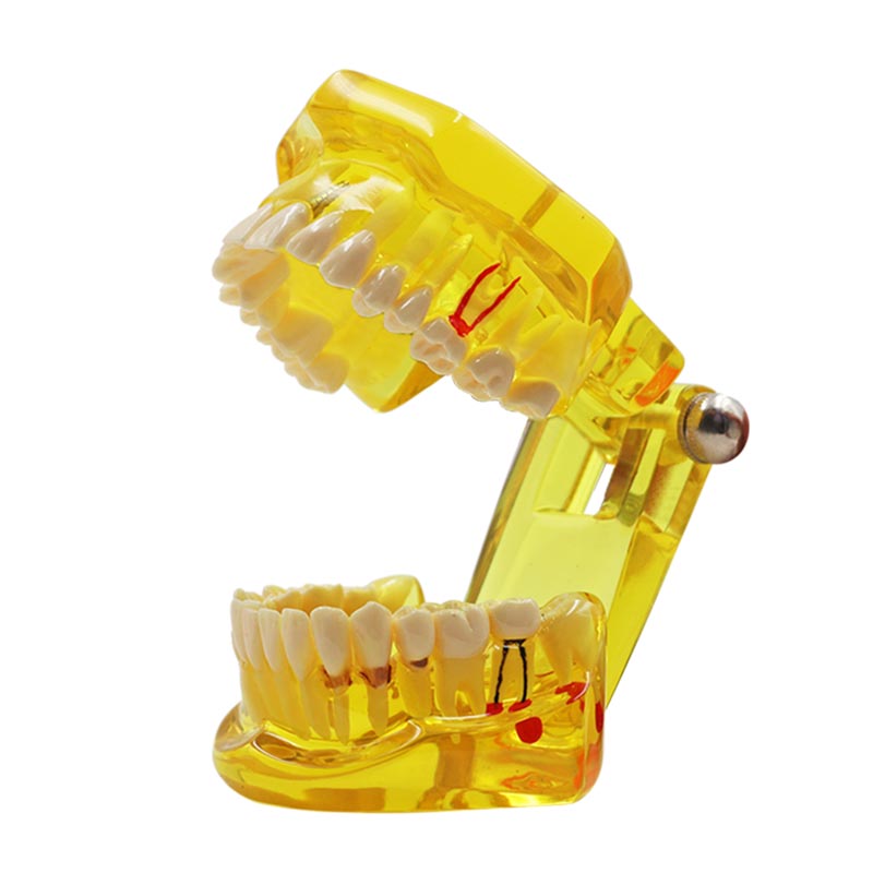 Modèle de dent multicolore, 1 pièce, modèle Standard d&#39;enseignement et d&#39;apprentissage dentaire pour adultes, utilisé dans les cliniques de stomatologie et de recherche: Yellow