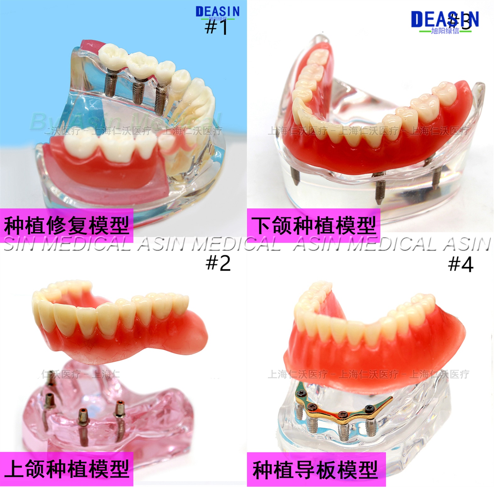 1 pc x Resin Coverage dental implant model dentures Removable teeth model for dentist study Deasin