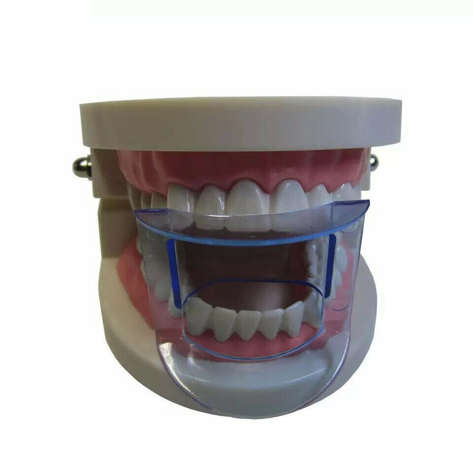 5 ~ 100Pis Dental Mond Gag Opener Anterior Bite Props Retractor Cheek Expander