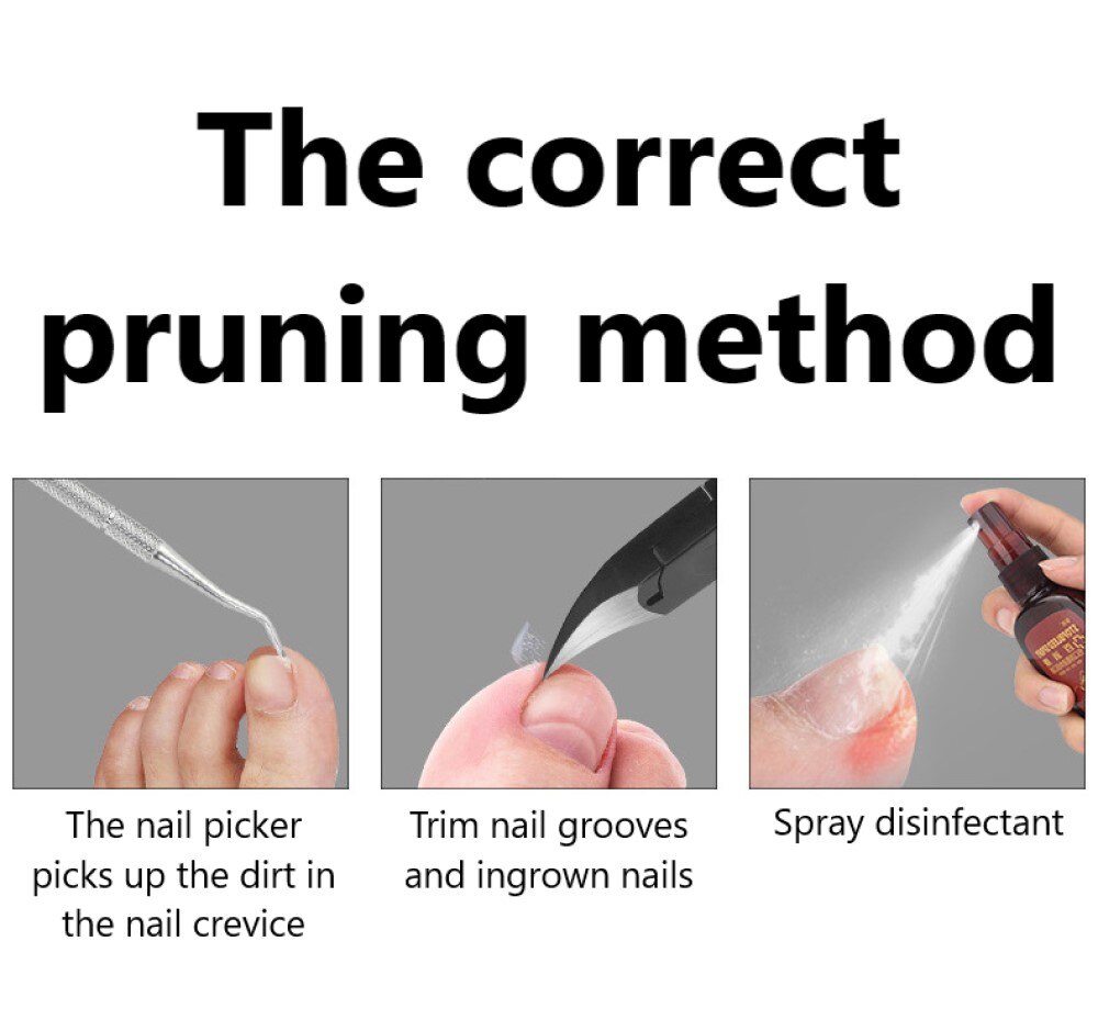 1 Pc Nail Art Clipper Nipper Manicure Vingernagel &amp; Teennagel Schaar Ingegroeide Dode Huid Tang Rvs Trimmen Care Tool