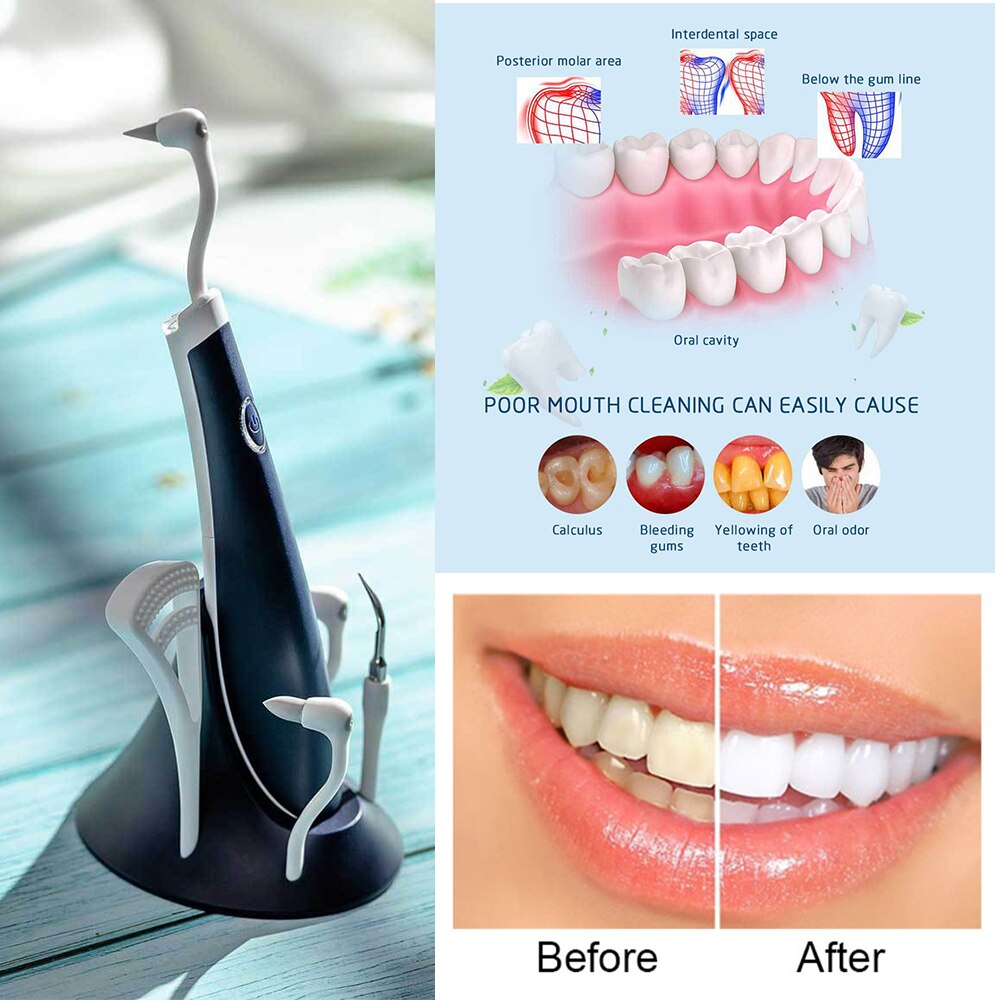 Dental Ultrasonic Scaler Handpiece Detachable Ultrasonic 5-in-1 with LED lighting With stand