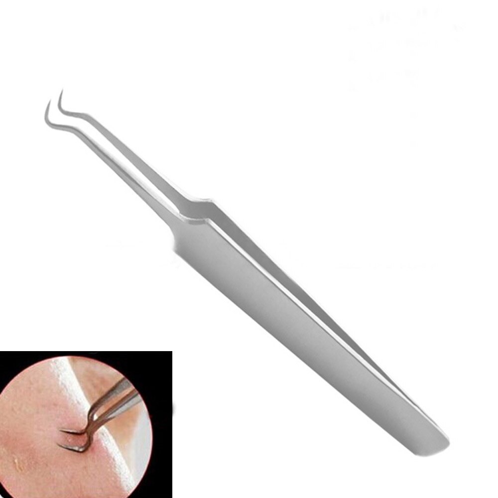1pc bøjede buede hudorme acne klip klip bums comedon remover værktøj ansigtsrens