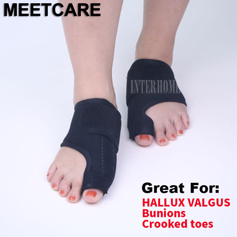 Hallux valgus hallux valgus hallux valgus knobbelspalk duim teen correctie voet pijnverlichting duimverzorging beschermer spalk pijnverlichting