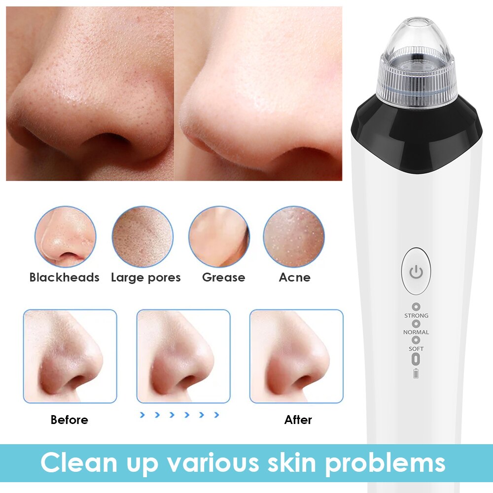 WiFi Camera Visual Face Blackhead Remover Vacuum Suction Pore Cleaner Face Deep Nose Cleasning Pimple Removal With 3 heads Tool