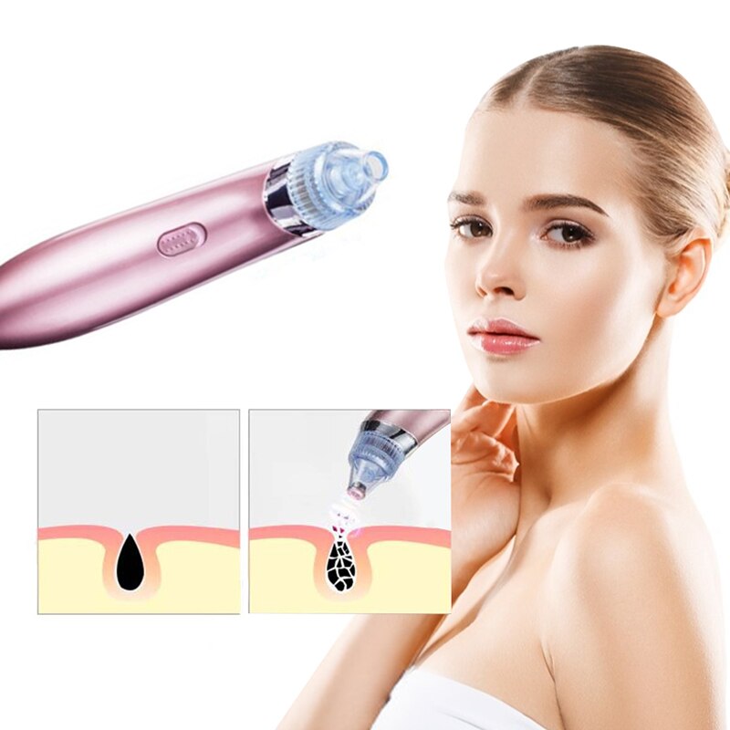 Mee-eter verwijderaar elektrische stofzuiger poriënreiniger mee-eter zuigmachine comedonen verwijderaar gezichtshuidverzorging