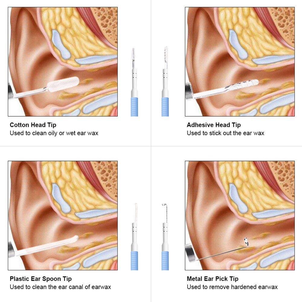 Endoscoop Camera Oor Schoonmaken Tool Ear Wax Remover Kit Care Oor Schoner Apparaat Oor Schoonmaken Persoonlijke Gezondheidszorg