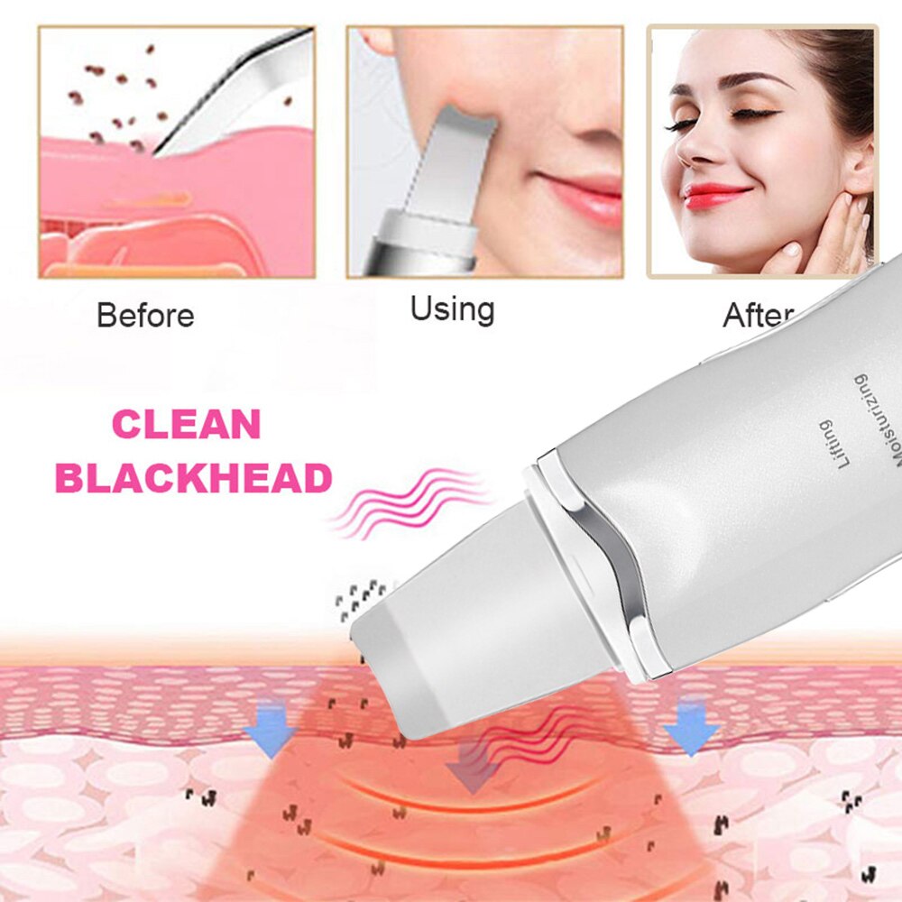 Ultralyd eksfolierende ansiktsrens scrubber hudorm kvisefjerner ansikt peeling maskin pore fuktighetsgivende ansiktsløftende maskin