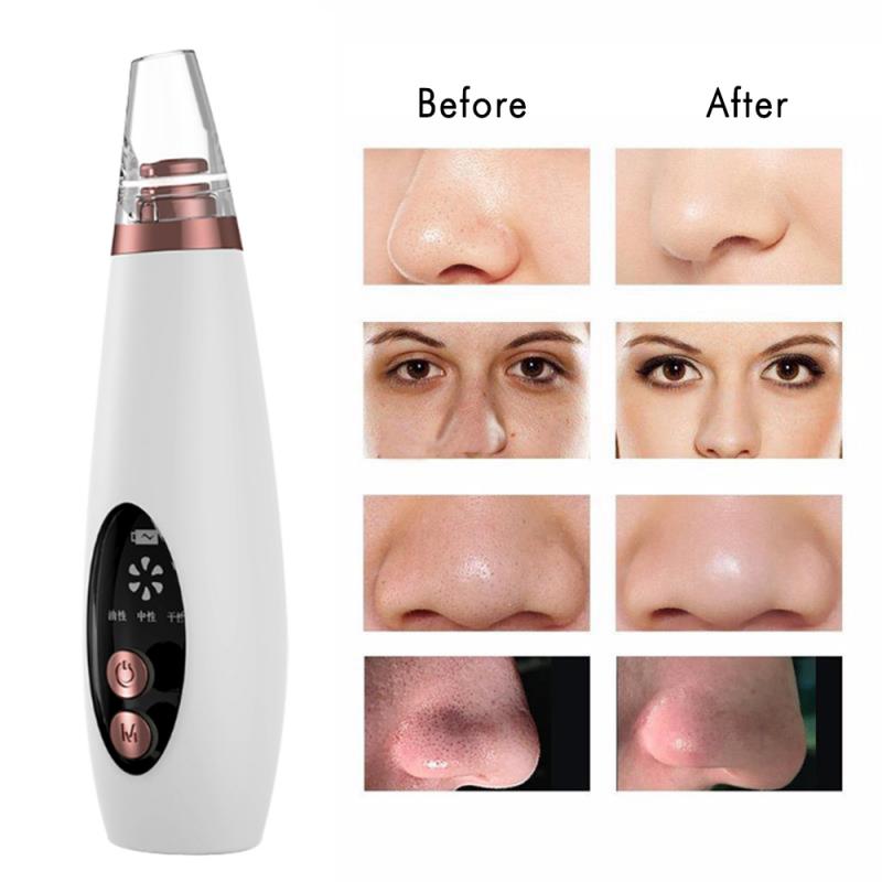 6/5Head Electric Blackhead Remover Pore Acne Pimple Removal Vacuum Suction Face Nose T Zone Deep Cleaner Machine