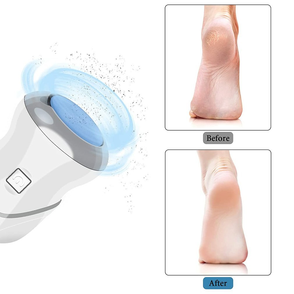 Grattoir à talons Rechargeable pour les pieds, dissolvant électrique de callosités, peau morte, 2 vitesses, 3 têtes de ponçage
