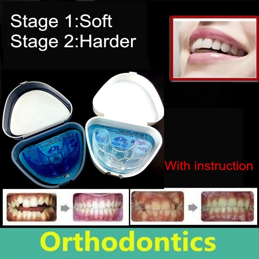 Justering tænder holder ortodontisk holder bukke tænder rette beslag uregelmæssige tænder tandbøjler mundstykker bøjler