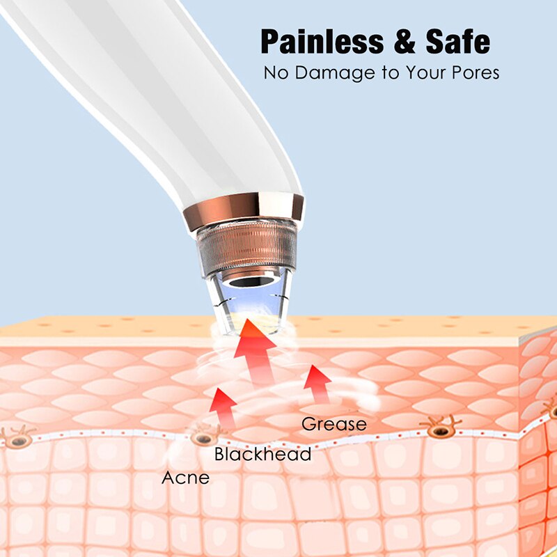 Electric Acne Remover Point Noir Blackhead Vacuum Extractor Tool Black Spots Pore Cleaner Skin Care Facial Pore Cleaner Machine