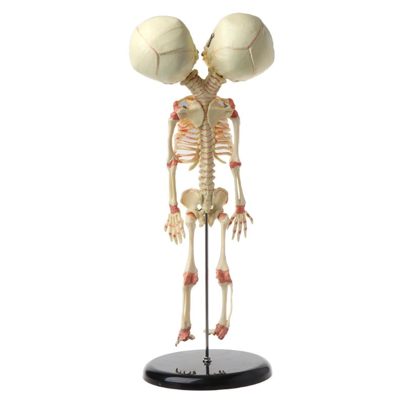 37cm mennesker dobbelt hoved baby kranie skelet anatomi hjerne display undersøgelse undervisning anatomisk model halloween bar ornament