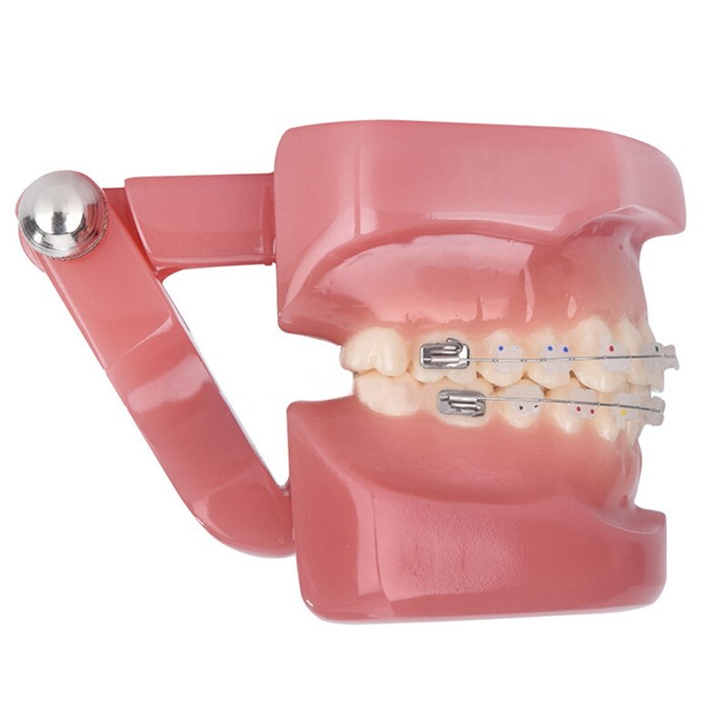 Teeth Model Implant Disease Teeth Model Dentist Studying Model
