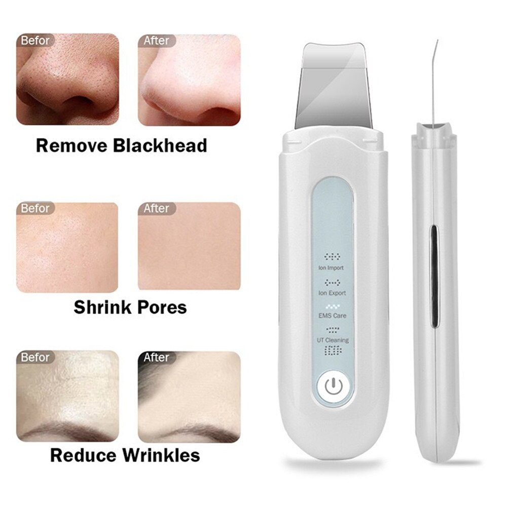 Ultrasone Huid Scrubber Diepe Gezicht Reiniging Schop Professionele Mee-eters Remover Peeling Gezicht Cleanser Skin Spatel Tool