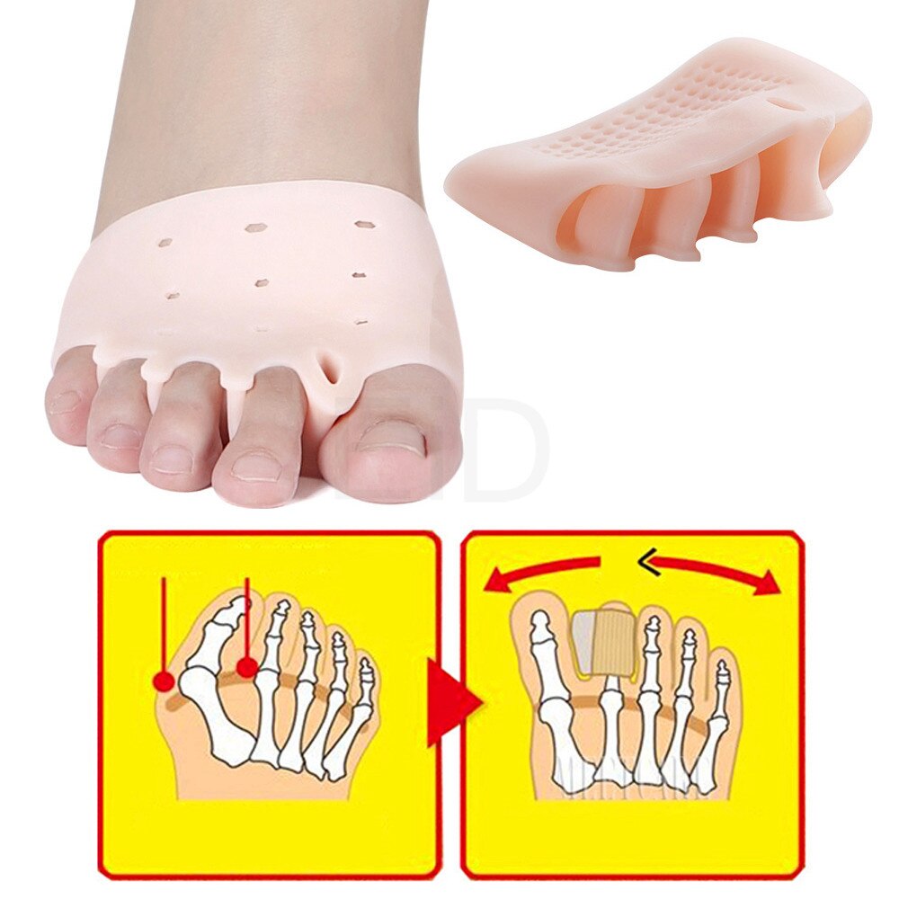 Indlægssåler hallux valgus orthotics knystpuder til separate alle tå store ben ortopædiske fodhammer korrektor separator indlæg pude