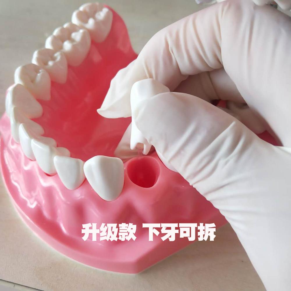 Dental Implant Teeth Model Teaching Study Model Dentist Resin Tooth Orthodontic Modeling For Student Practice