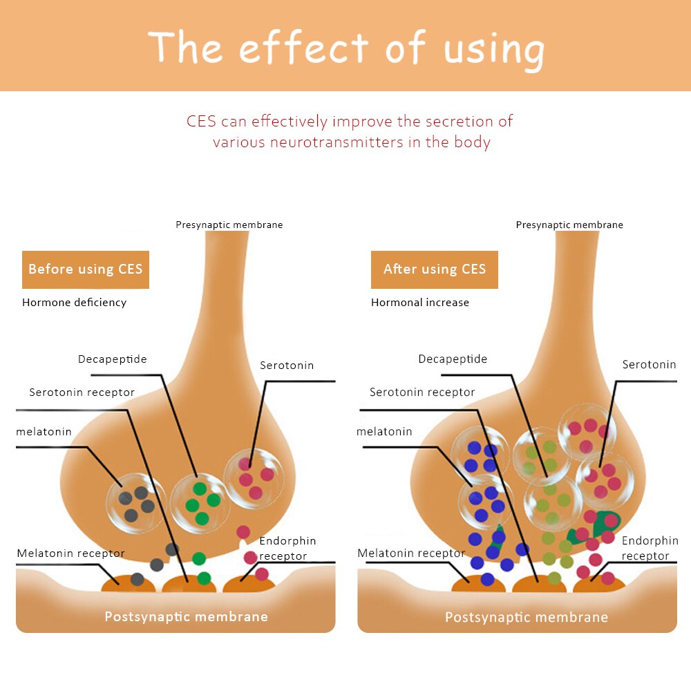 Microcurrent Sleep Aid Device Sleep Holding Sleep Aid Instrument Hypnosis Instrument Pressure Relief Relax Massager USB Charging