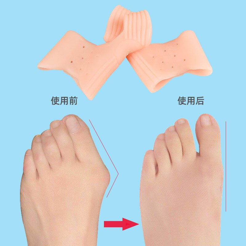 2Pcs Silicone Hallux Valgus Toe Separator Silicone Insoles Toe Overlapping Pain Relieve Spreader Foot Protector Inserts Orthosis