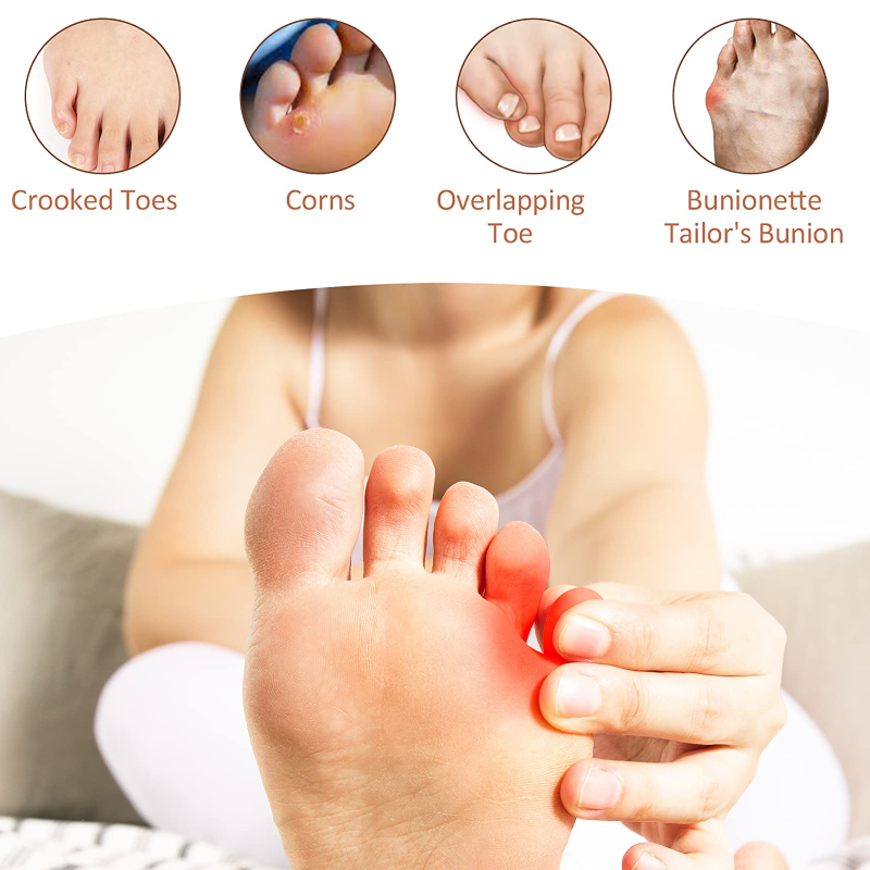 2 stk = 1 par lilletå hallux valgus korrigerer tåreim silikongel hallux valgus puter avstandsstykke fotpleie rettetang ortopedisk