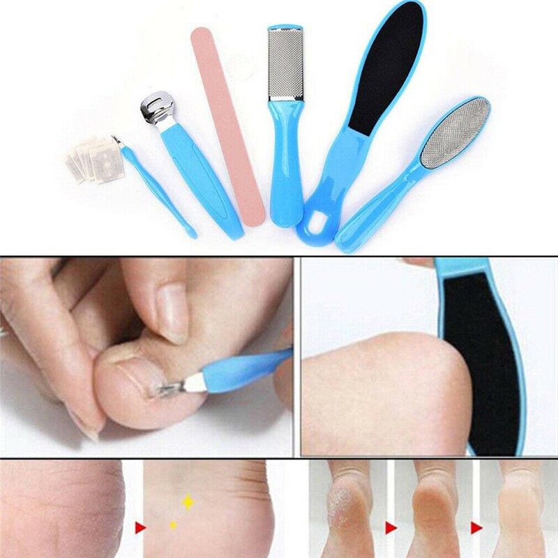 8Pcs Nail Tools Pedicure Kit Rasp Foot File Callus Remover Nail Care Tools Foot Rasps