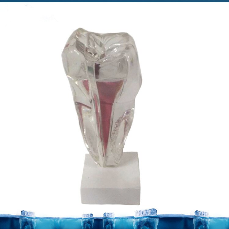 6X Zes Keer De Tand Zenuw Anatomie Onderwijs Model Pathologische Tandheelkundige Tand Tanden Anatomie Model Medische Anatomie Odontologia
