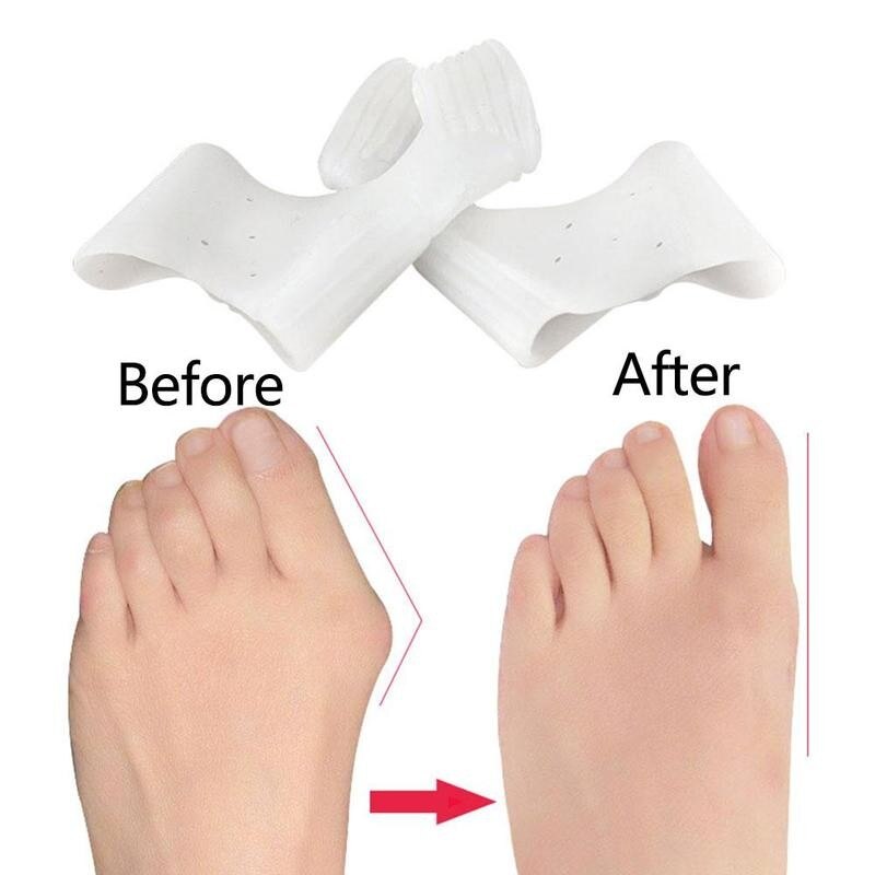 1 Paar Siliconen Teen Separator Corrector Duim Voeten Bunion Hallux Zachte Richter Teen Protector Valgus Stijltang Care Q8Q1