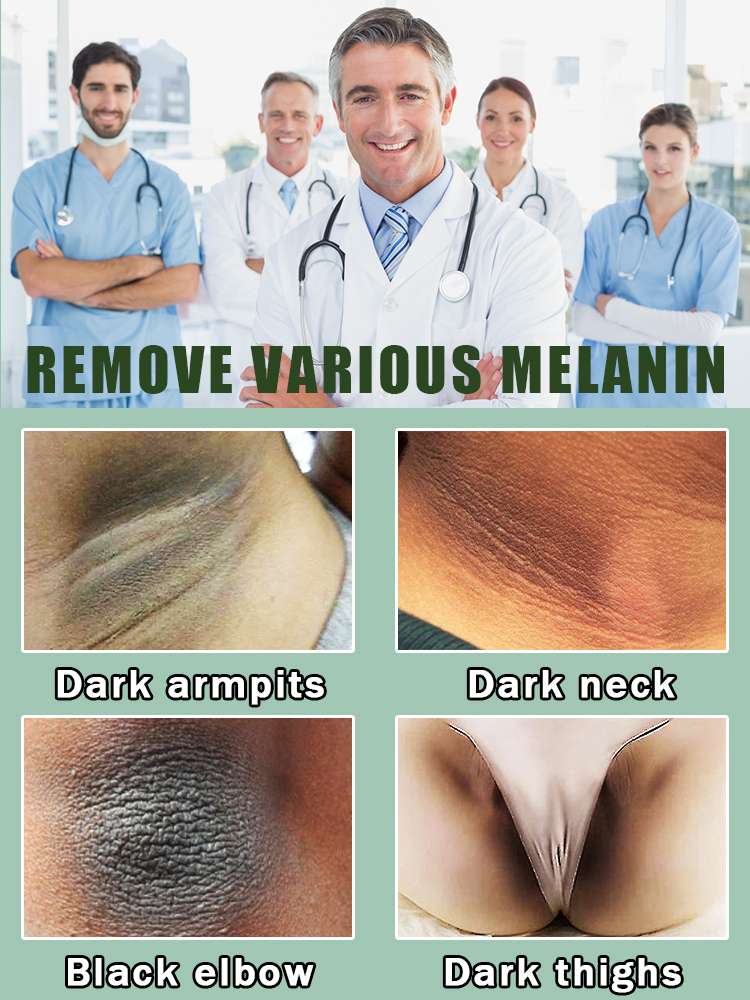 zie vaarwel tegen melanine