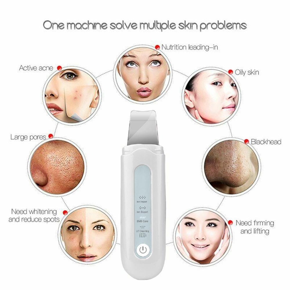 Ultrasound Skin Scrubber Exfoliërende Anti-Rimpel Huid Scrubber Met 4 Modellen Comedondrukker Skin Spatel Gereedschappen