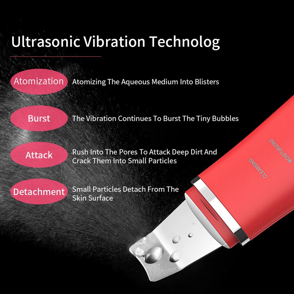Limpiador ultrasónico de piel ANLAN, máquina de limpieza por vibración Facial, exfoliante de espinillas, exfoliante de poros, herramientas de limpieza Facial