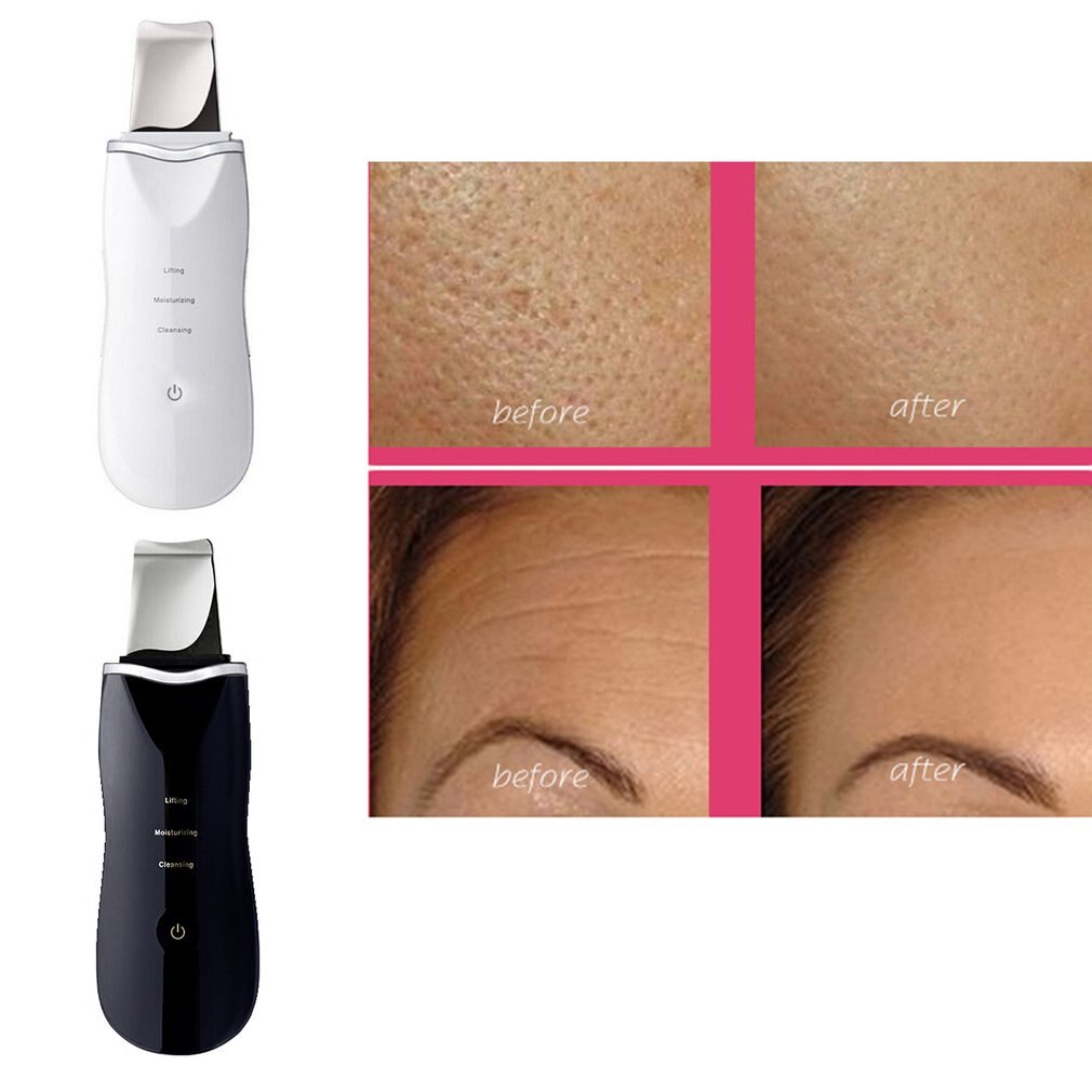 CPJ001 Multifunctional Lcd Shovel Skin Machine Pore Cleaner Blackhead Instrument Ultrasonic Household Facial Beauty