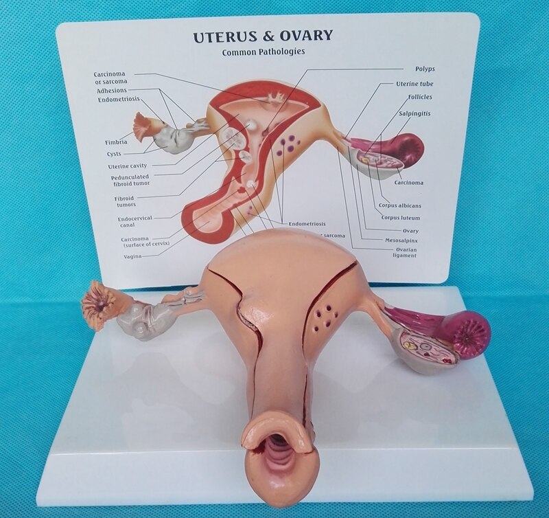 Female pathological uterus model Advanced simulation pathological uterus model of structure anatomy of gynecology and obstetrics