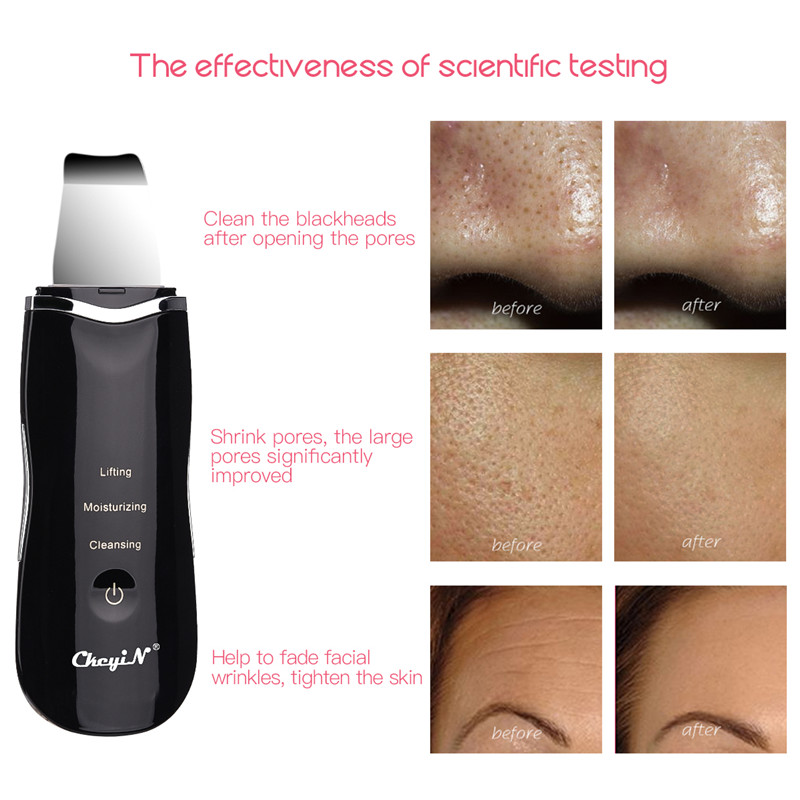 Ultrasonic Skin Scrubber Skin Peeling Extractor Facial Deep Cleaning Beauty Device + Skin Rejuvenation Nano Face Mist Steamer 40