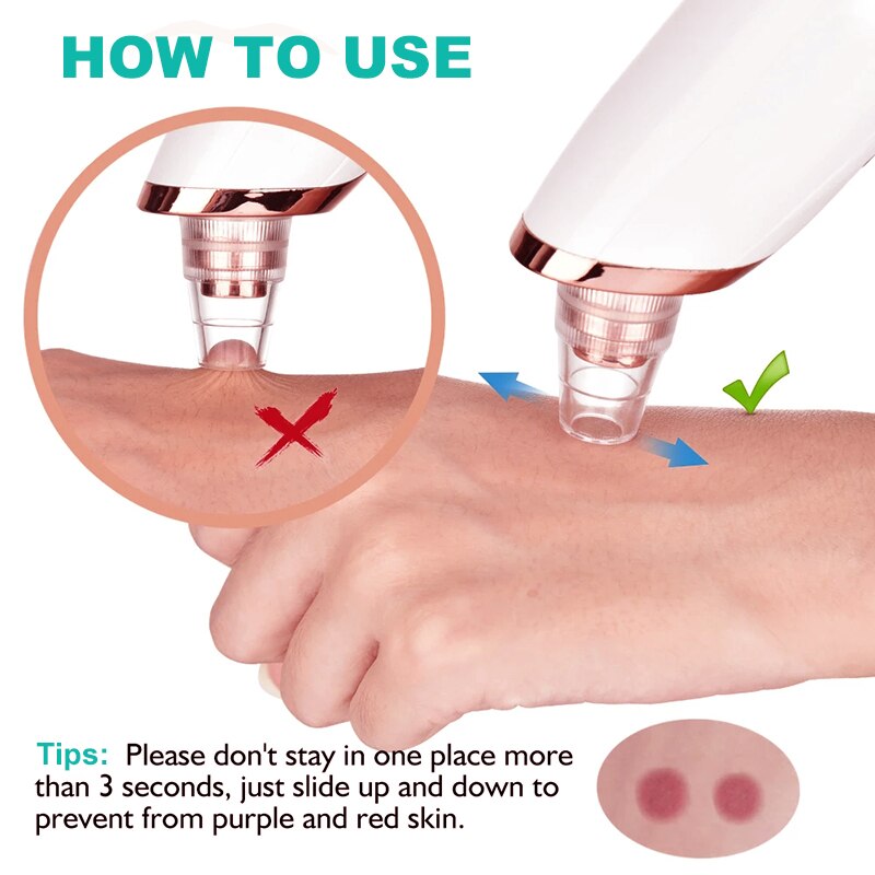 Blackhead Remover Vacuum Acne Suction Pimple Black Head Remove Skin Blackheads Cleaner Face Skin Cleaning Suction Black Points