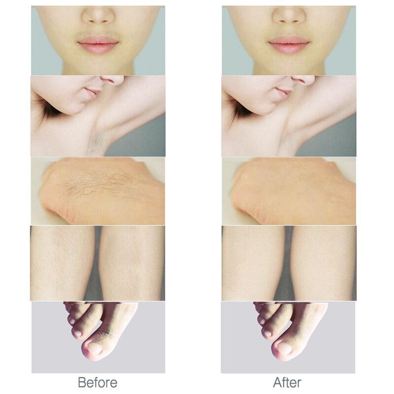 JINDING Women Hair Removal Portable Bikini Trimmer Shaving Machine Lady Shaver USB Rechargeable Electric Razor Body Hair Remover
