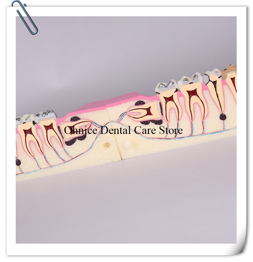Periodontal disease teeth model M4009/dental teaching model Molar cross section study teeth model