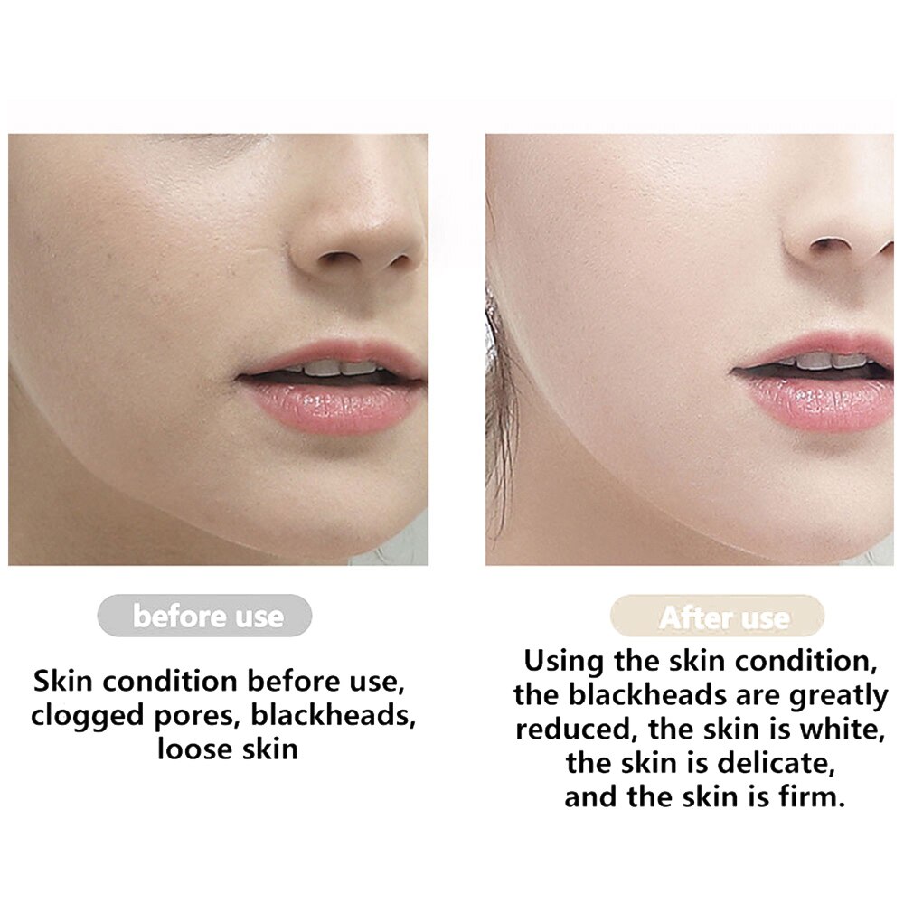 Multifunction Blackhead Removal Equipment Beauty Remove Clear USB Charging White/Pink EMS Pore Contraction Woman