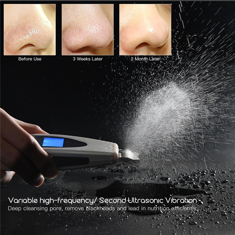 Ultrasonic Face Skin Scrubber Facial Cleaner Peeling Facial Blackhead Removal Pimples Pore Black Spot Cleaner Tool