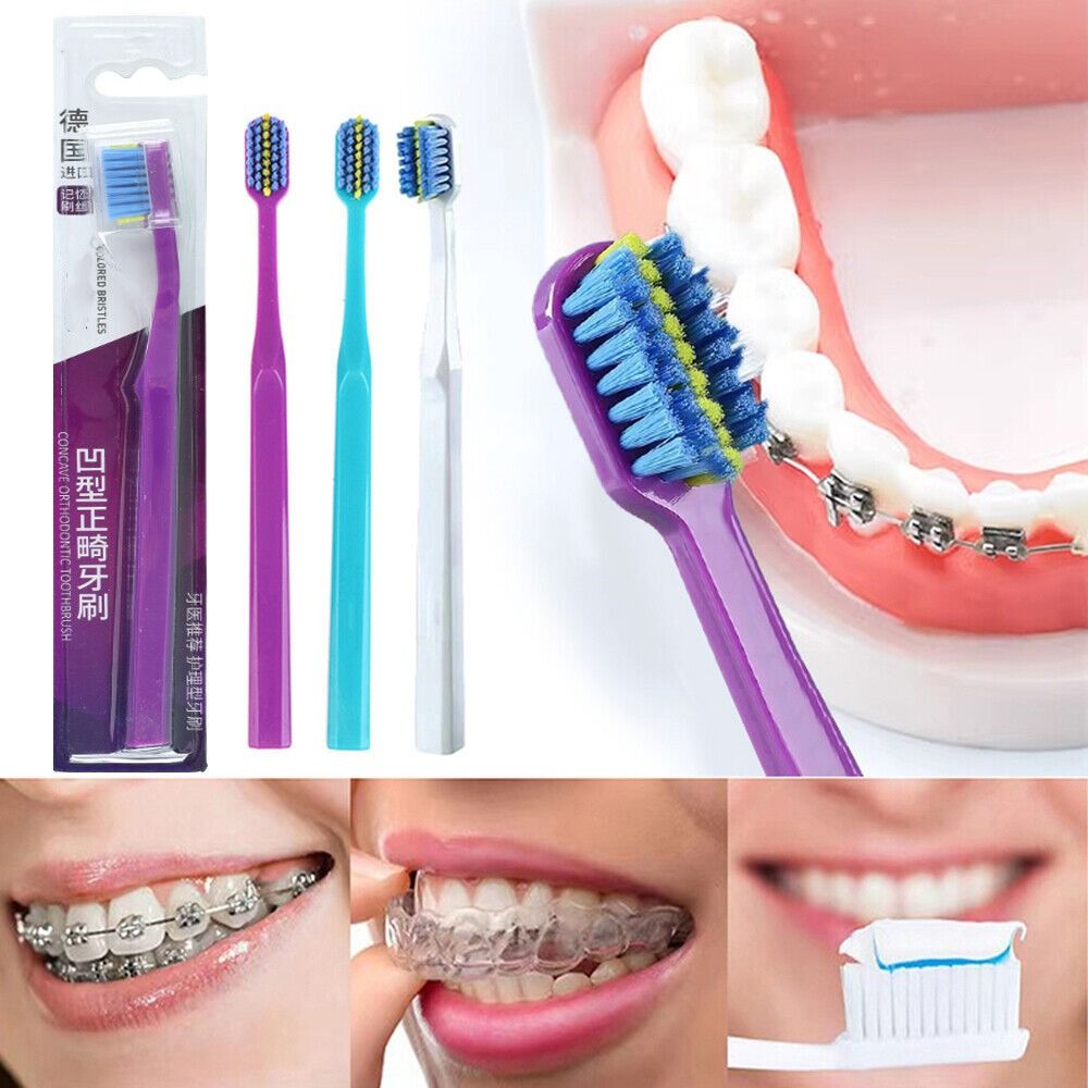Interdentalbürste für Mundhygiene, PP-Griff, weiche Borsten, kieferorthopädische Reinigungsbürste, Oral Health Care, saubere kieferorthopädische Zahnspangen