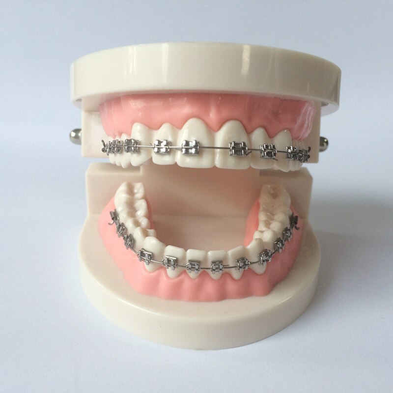 Orthodontische Onderwijs Model Met Buccale Buizen/Orthodontische Practice Tanden Model Met Beugel/Dental Orthodontische Tanden Model