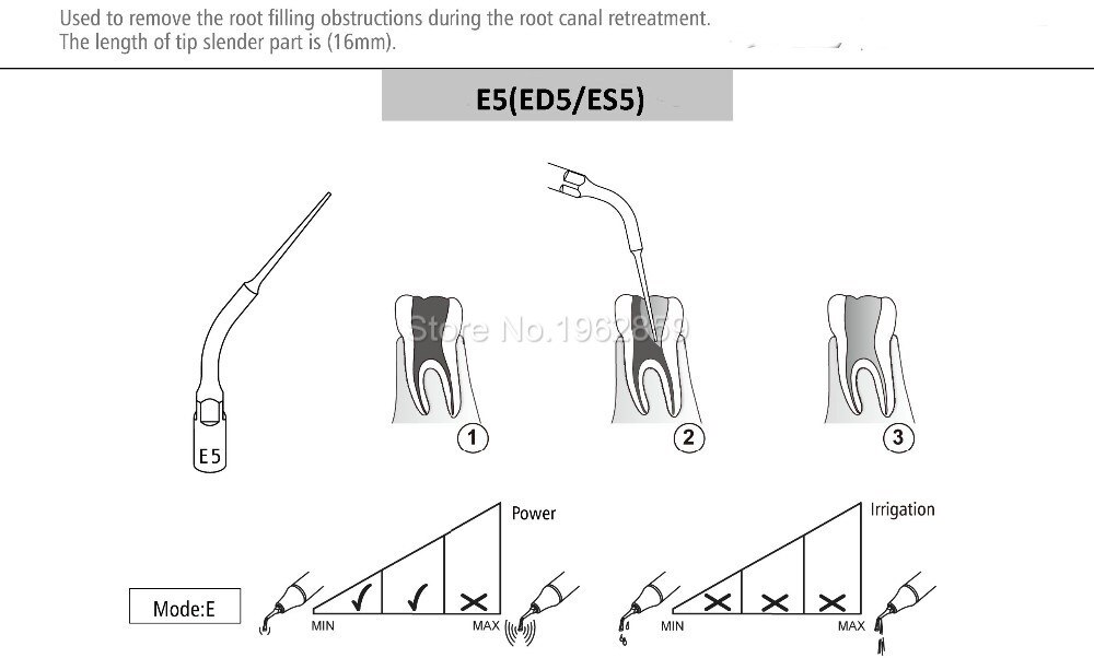 2pcs E5 Dental Ultrasonic Scaler Scaling Tips fit EMS Woodpecker UDS Handpiece Tip Tools