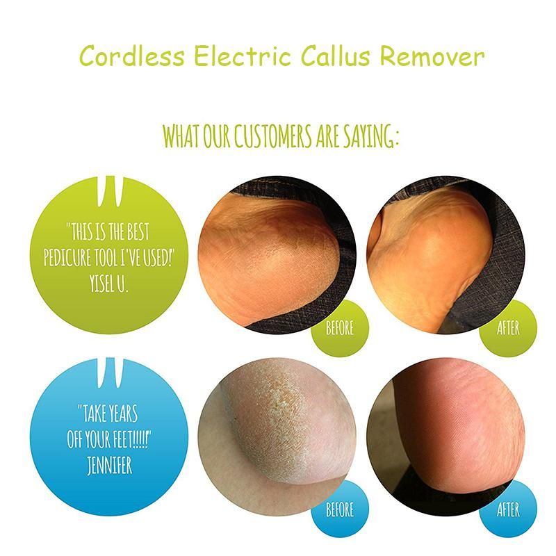 Cordless Electric Callus Remover