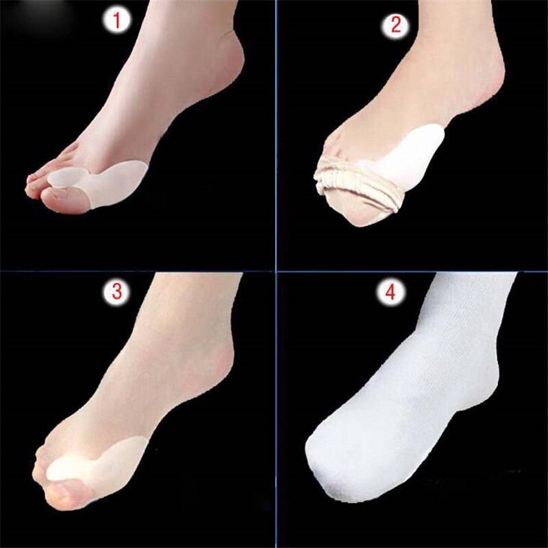 Corrector de pedicura ortesis de , Hallux Valgus Pro, ortopédico, suave, para separador de dedos grandes para juanete, herramienta ortopédica