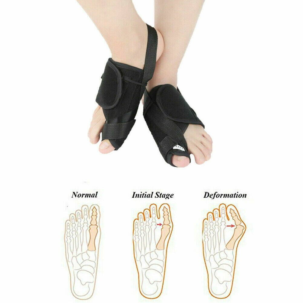Voetverzorging Bunion Spalk Grote Teen Straightener Corrector Foot Pain Relief Hallux Valgus Orthopedische Levert Pedicure