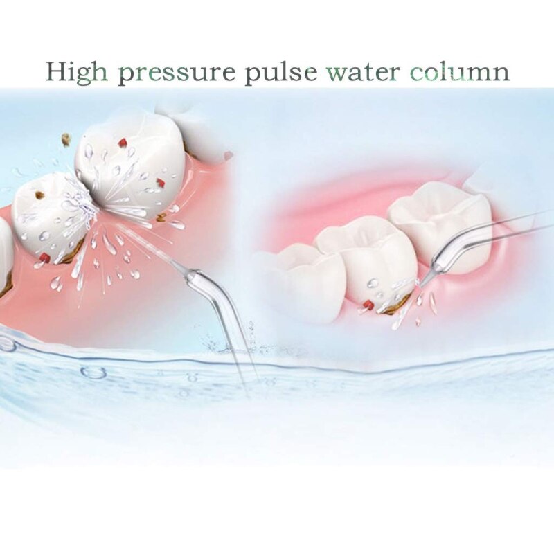 Replacement Tips for Waterpik Periodontal Tips Dental Water Flosser Random Color