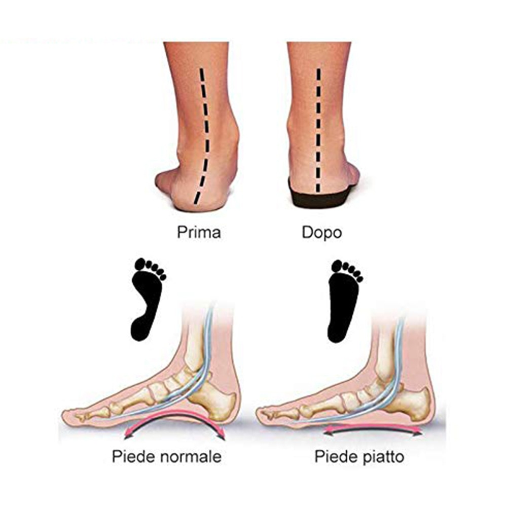 Separadores de dedos de los pies, alisadores elásticos ortopédicos, espaciadores de dedos de los pies, Corrector de juanetes, herramientas de cuidado de pie para hombre y mujer, pedicura, 1 par